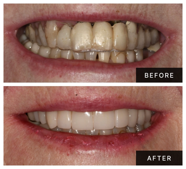 Real Patient Smiles & Transformations